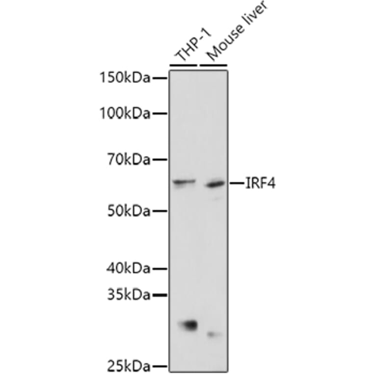 Western Blot - Anti-MUM1 Antibody (A11160) - Antibodies.com