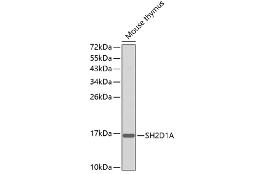 Western Blot - Anti-SH2D1A Antibody (A0525) - Antibodies.com