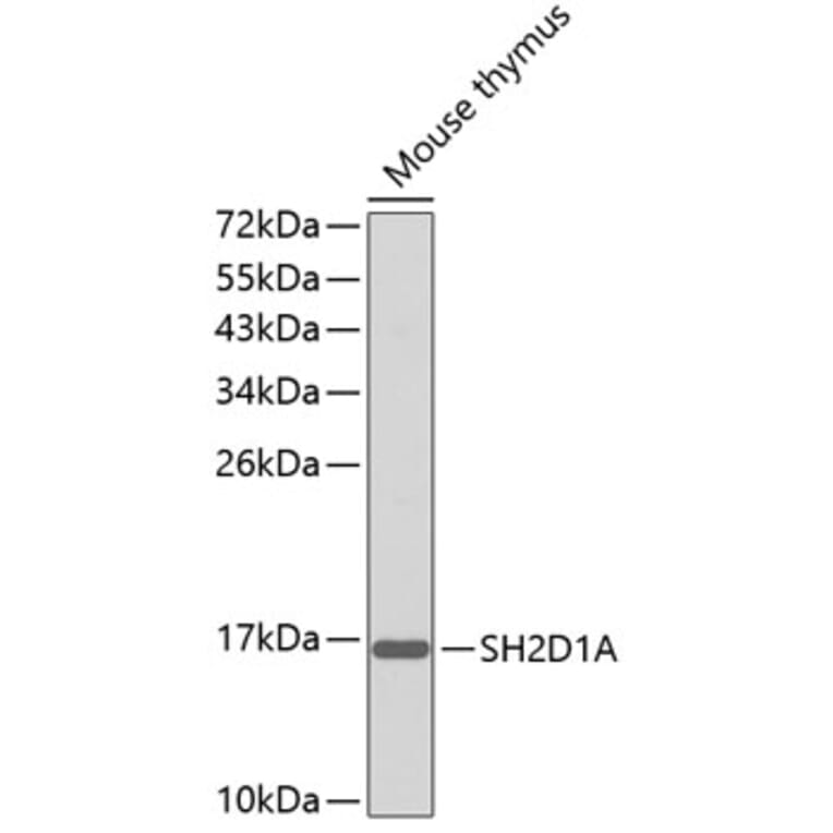 Western Blot - Anti-SH2D1A Antibody (A0525) - Antibodies.com