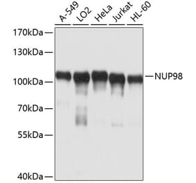 Western Blot - Anti-NUP98 Antibody (A11162) - Antibodies.com