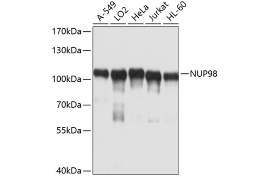 Western Blot - Anti-NUP98 Antibody (A11162) - Antibodies.com
