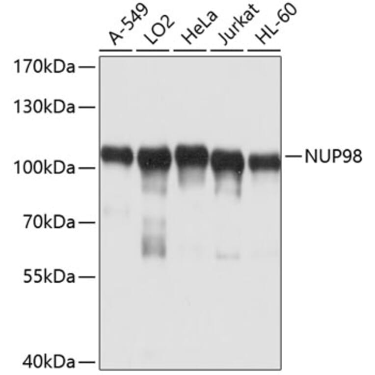 Western Blot - Anti-NUP98 Antibody (A11162) - Antibodies.com