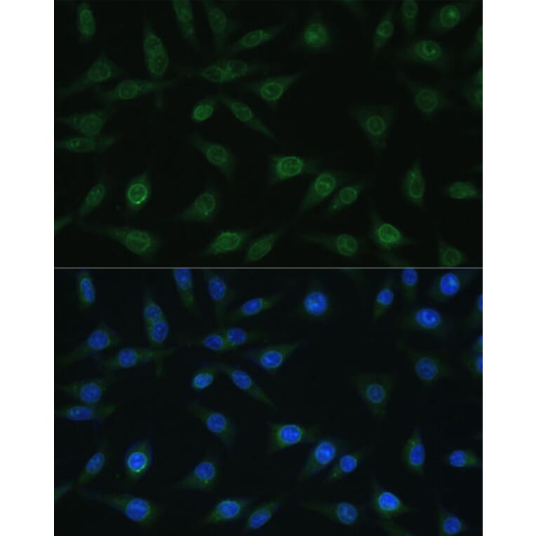 Immunofluorescence - Anti-NUP98 Antibody (A11162) - Antibodies.com