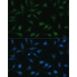 Immunofluorescence - Anti-NUP98 Antibody (A11162) - Antibodies.com