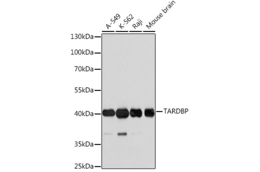 Western Blot - Anti-TARDBP Antibody (A0538) - Antibodies.com