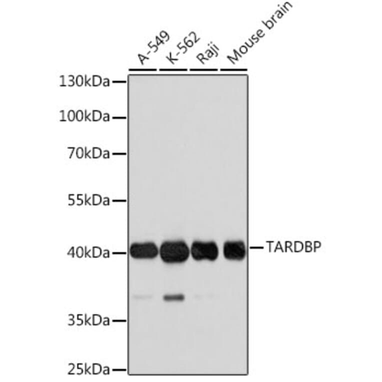 Western Blot - Anti-TARDBP Antibody (A0538) - Antibodies.com