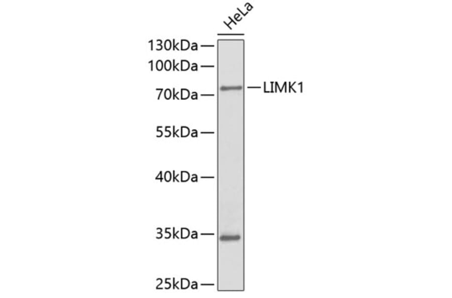 Western Blot - Anti-LIMK1 Antibody (A0547) - Antibodies.com