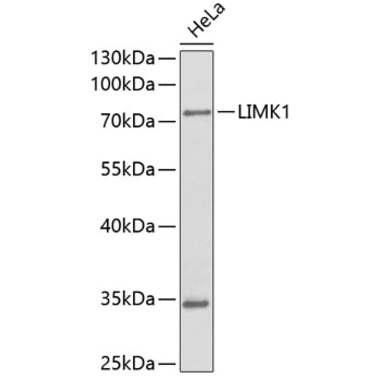 Western Blot - Anti-LIMK1 Antibody (A0547) - Antibodies.com