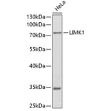 Western Blot - Anti-LIMK1 Antibody (A0547) - Antibodies.com