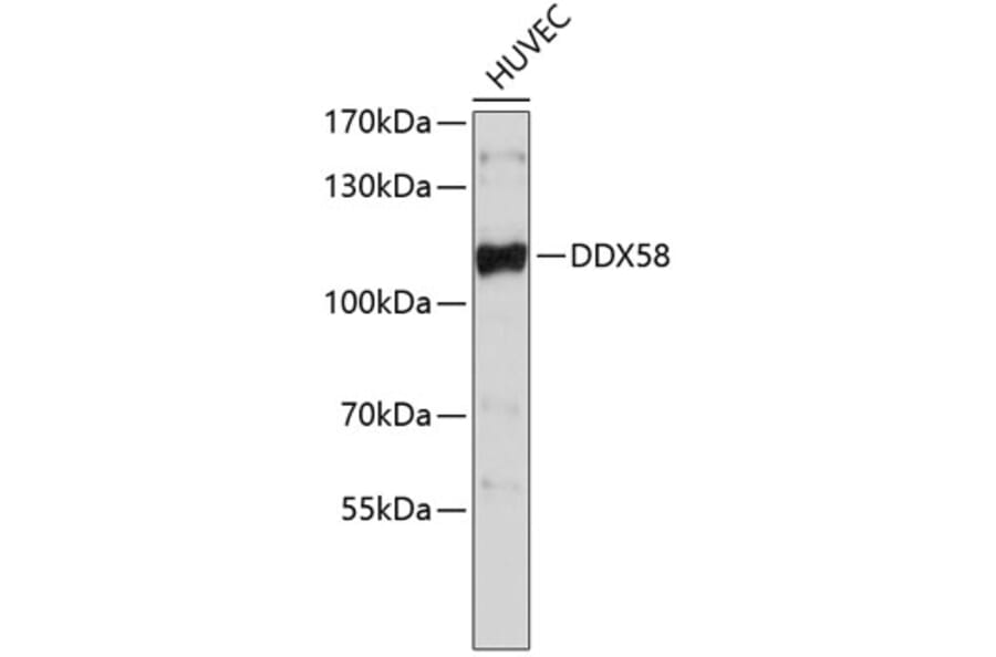 Western Blot - Anti-DDX58 Antibody (A0549) - Antibodies.com