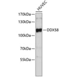 Western Blot - Anti-DDX58 Antibody (A0549) - Antibodies.com