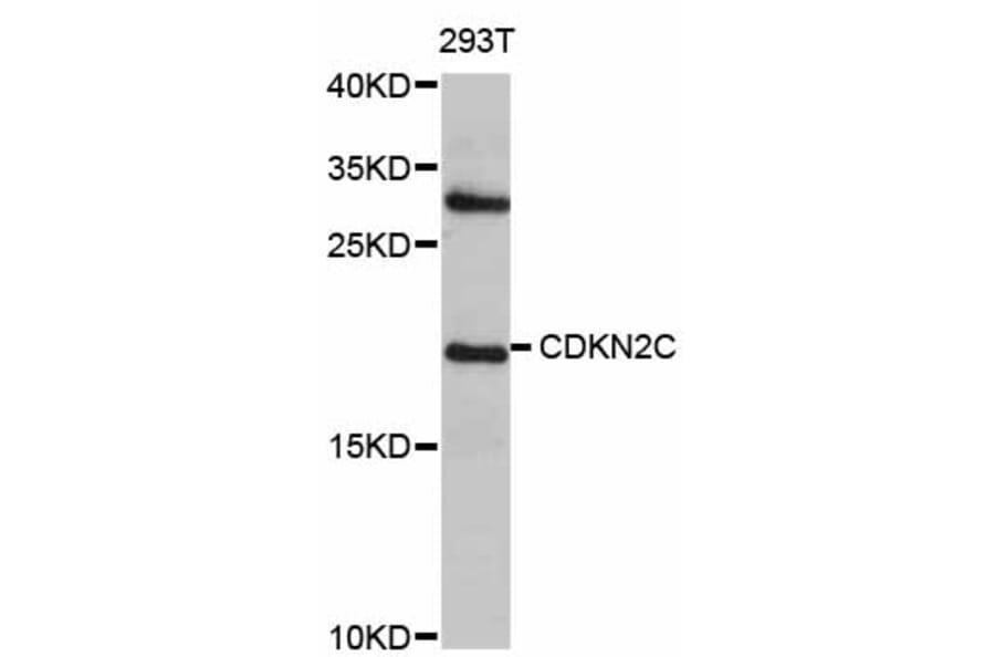 Western Blot - Anti-CDKN2C Antibody (A0557) - Antibodies.com