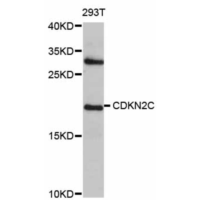 Western Blot - Anti-CDKN2C Antibody (A0557) - Antibodies.com