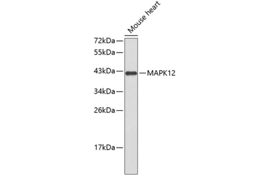 Western Blot - Anti-MAPK12 Antibody (A0559) - Antibodies.com