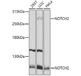 Western Blot - Anti-Notch2 Antibody (A11168) - Antibodies.com