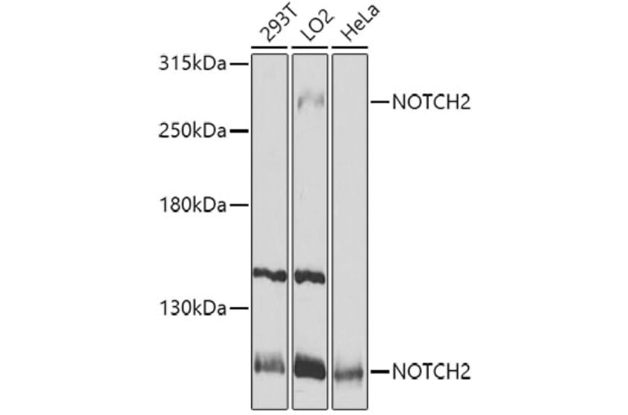 Western Blot - Anti-Notch2 Antibody (A11168) - Antibodies.com