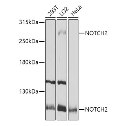 Western Blot - Anti-Notch2 Antibody (A11168) - Antibodies.com