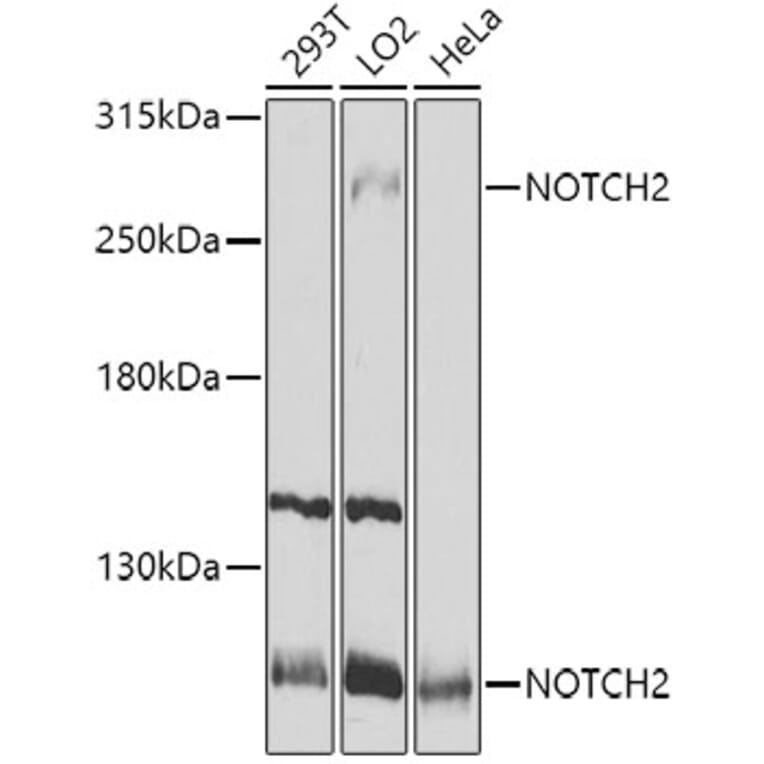 Western Blot - Anti-Notch2 Antibody (A11168) - Antibodies.com