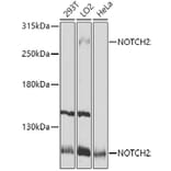 Western Blot - Anti-Notch2 Antibody (A11168) - Antibodies.com