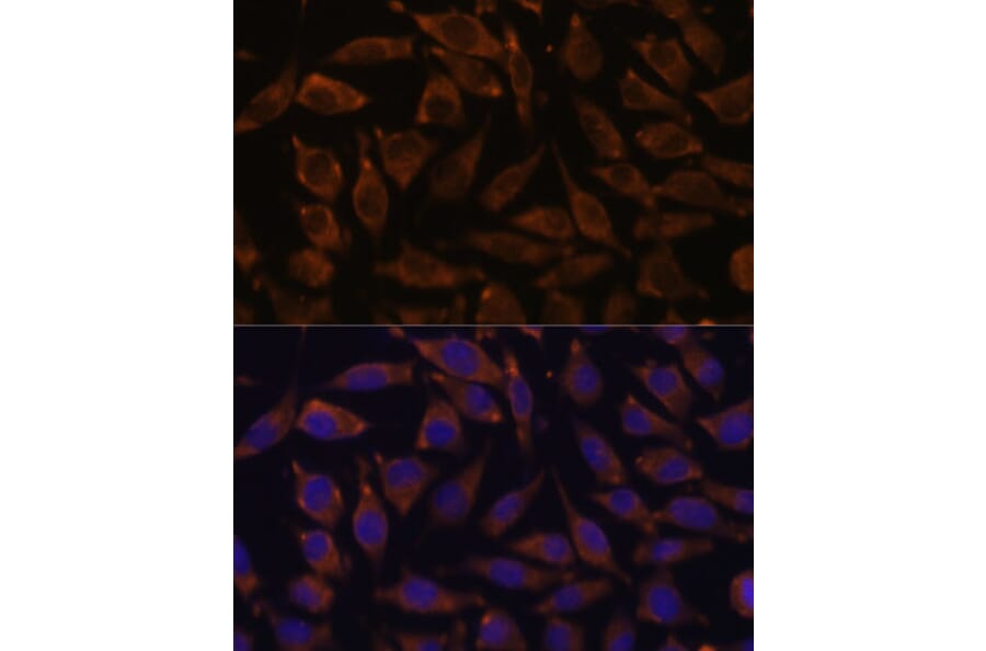 Immunofluorescence - Anti-Notch2 Antibody (A11168) - Antibodies.com