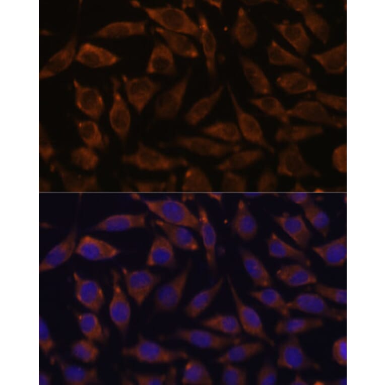 Immunofluorescence - Anti-Notch2 Antibody (A11168) - Antibodies.com