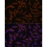 Immunofluorescence - Anti-Notch2 Antibody (A11168) - Antibodies.com