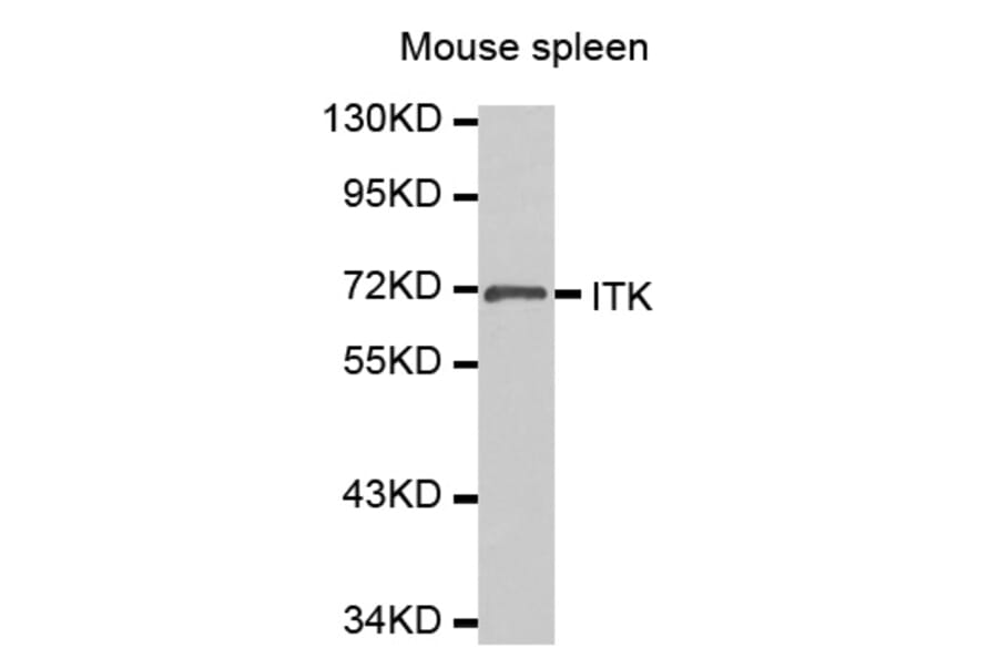 Western Blot - Anti-ITK Antibody (A0566) - Antibodies.com