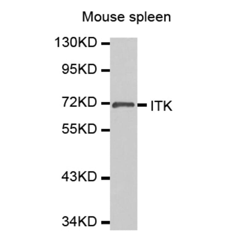 Western Blot - Anti-ITK Antibody (A0566) - Antibodies.com