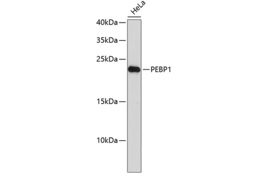 Western Blot - Anti-PEBP1 Antibody (A0577) - Antibodies.com