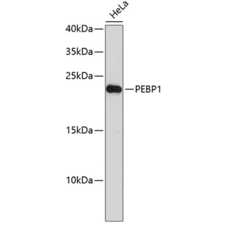 Western Blot - Anti-PEBP1 Antibody (A0577) - Antibodies.com