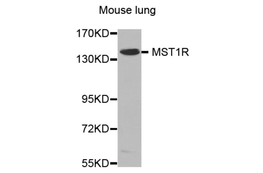 Western Blot - Anti-MST1R Antibody (A0590) - Antibodies.com