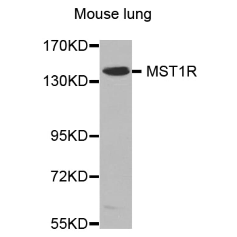 Western Blot - Anti-MST1R Antibody (A0590) - Antibodies.com