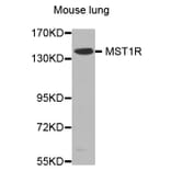 Western Blot - Anti-MST1R Antibody (A0590) - Antibodies.com