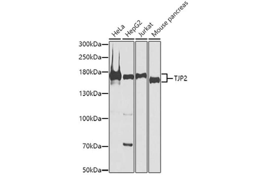 Western Blot - Anti-TJP2/ZO2 Antibody (A11173) - Antibodies.com
