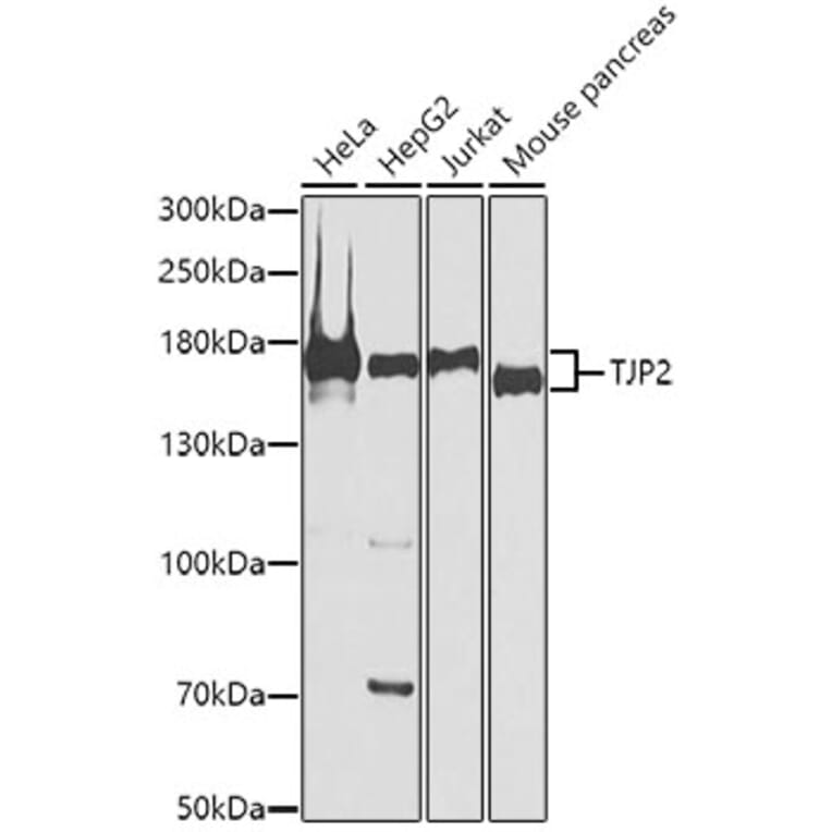 Western Blot - Anti-TJP2/ZO2 Antibody (A11173) - Antibodies.com