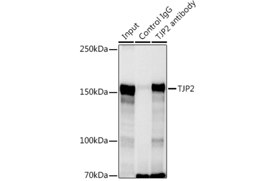 Western Blot - Anti-TJP2/ZO2 Antibody (A11173) - Antibodies.com