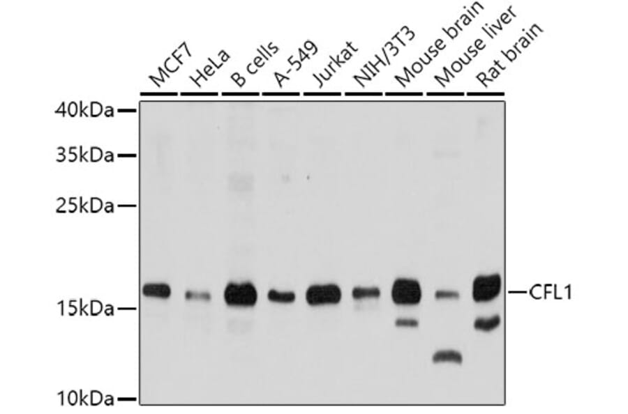 Western Blot - Anti-CFL1 Antibody (A0607) - Antibodies.com