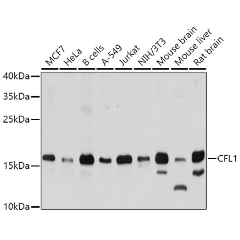 Western Blot - Anti-CFL1 Antibody (A0607) - Antibodies.com