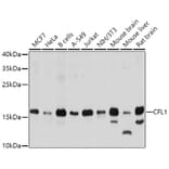 Western Blot - Anti-CFL1 Antibody (A0607) - Antibodies.com