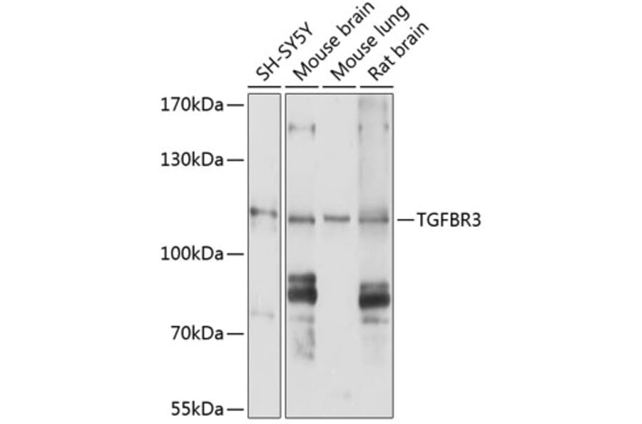 Western Blot - Anti-TGF beta Receptor III/TGFBR3 Antibody (A11175) - Antibodies.com
