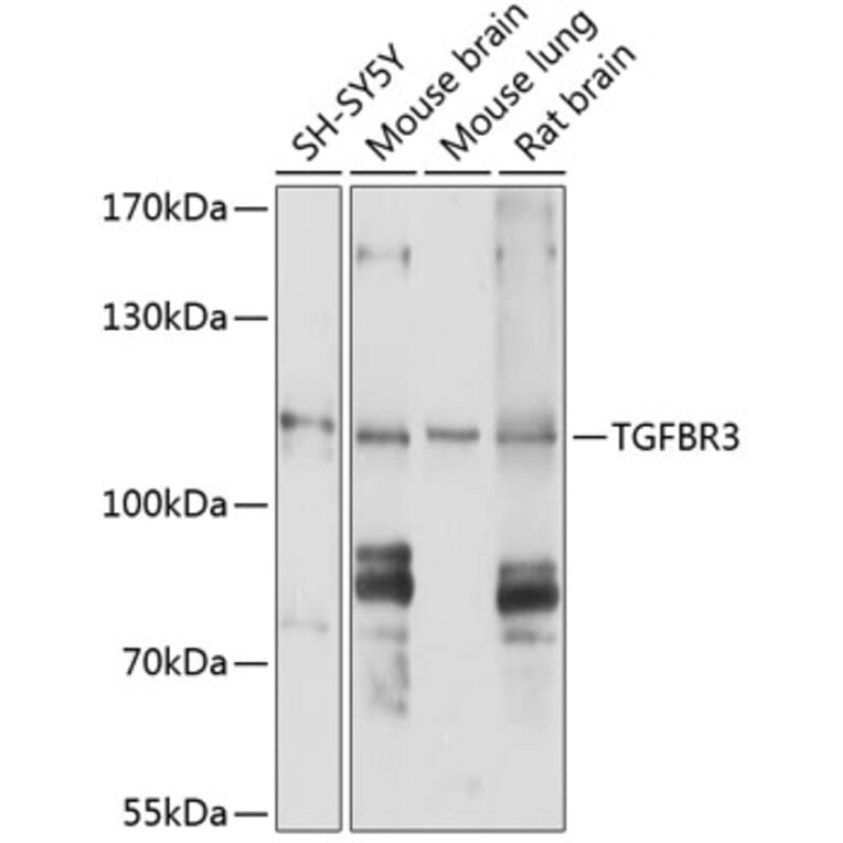 Western Blot - Anti-TGF beta Receptor III/TGFBR3 Antibody (A11175) - Antibodies.com