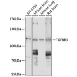 Western Blot - Anti-TGF beta Receptor III/TGFBR3 Antibody (A11175) - Antibodies.com