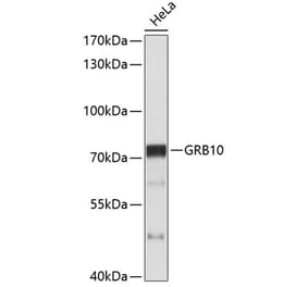 Western Blot - Anti-GRB10 Antibody (A11176) - Antibodies.com