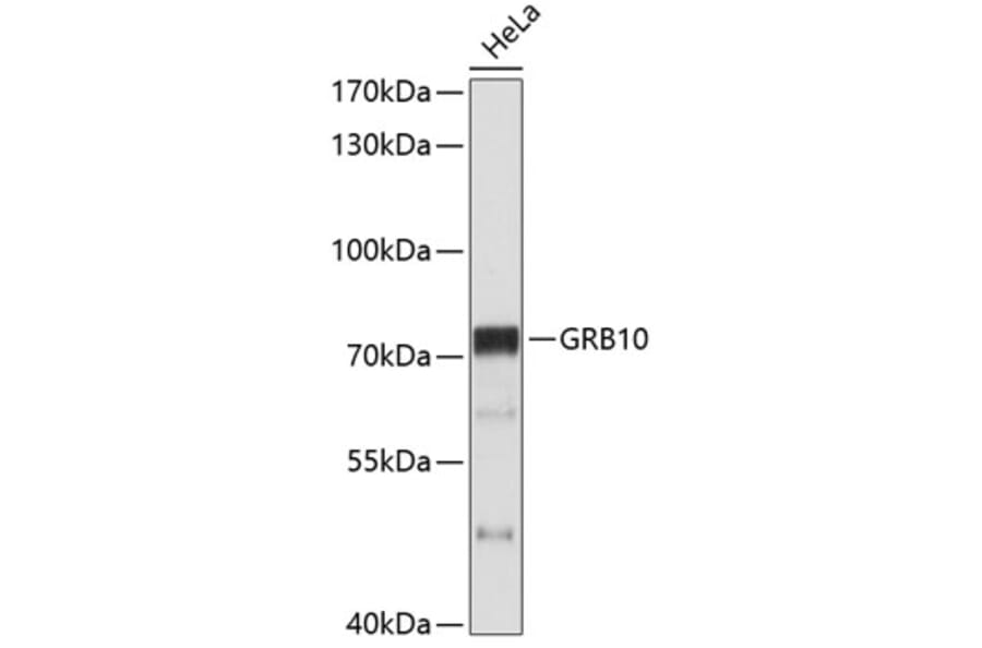Western Blot - Anti-GRB10 Antibody (A11176) - Antibodies.com
