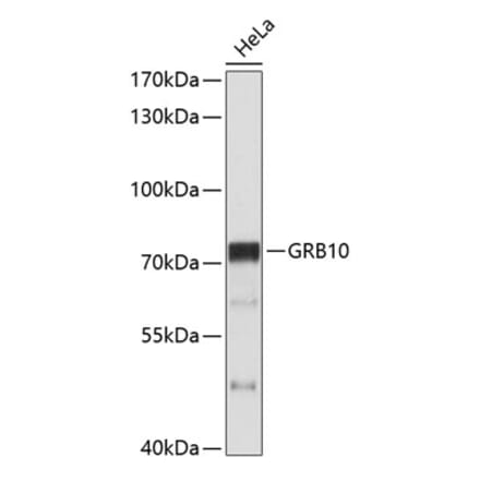 Western Blot - Anti-GRB10 Antibody (A11176) - Antibodies.com