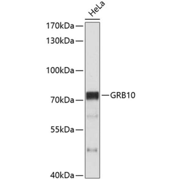 Western Blot - Anti-GRB10 Antibody (A11176) - Antibodies.com