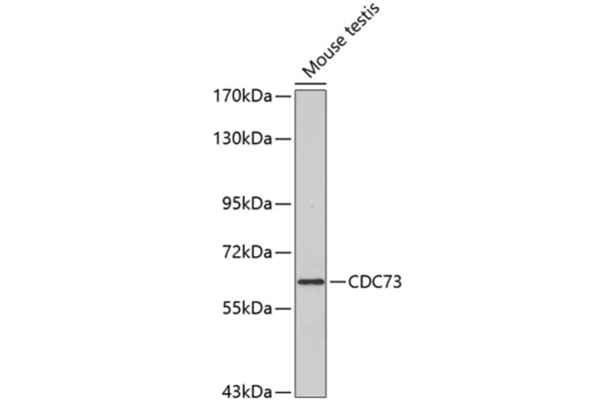 Western Blot - Anti-HRPT2/Parafibromin Antibody (A11177) - Antibodies.com
