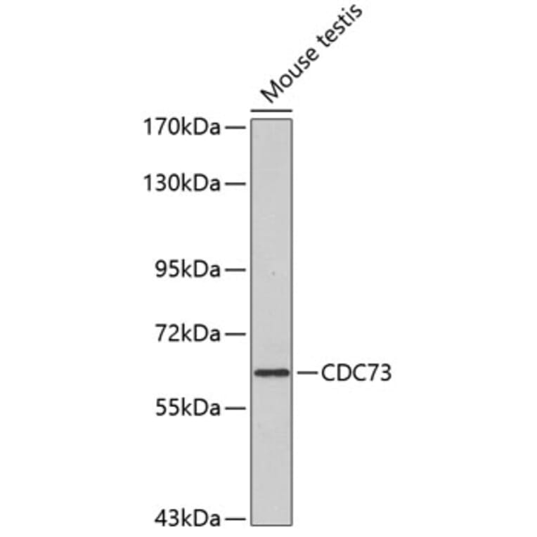 Western Blot - Anti-HRPT2/Parafibromin Antibody (A11177) - Antibodies.com