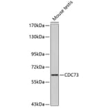 Western Blot - Anti-HRPT2/Parafibromin Antibody (A11177) - Antibodies.com