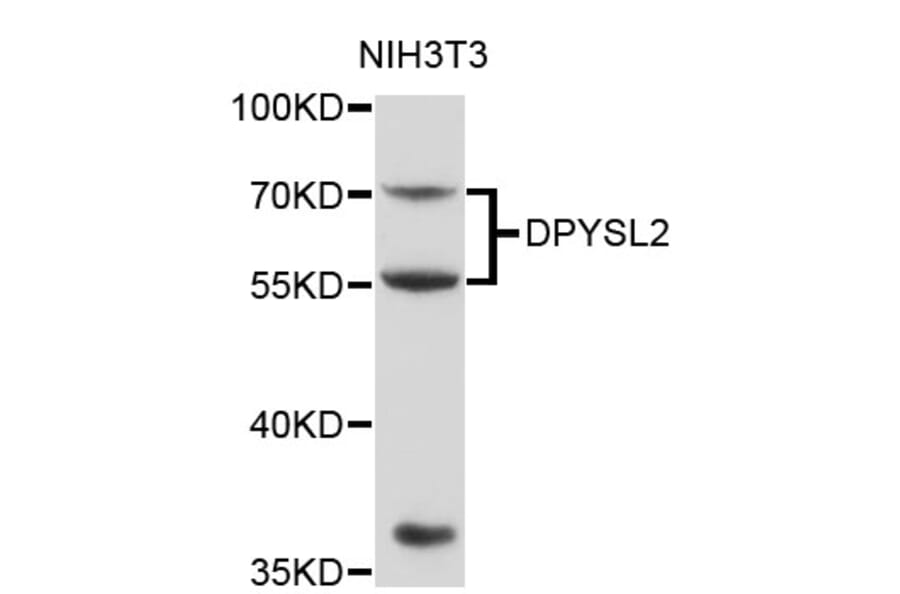 Western Blot - Anti-DPYSL2 Antibody (A0652) - Antibodies.com